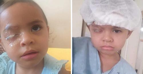 Menina de 2 anos grudou olho com supercola e esperou 5 dias por cirurgia