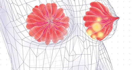 Câncer de mama: plataforma inteligente detecta e perfila a doença